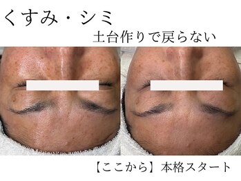 セレニア ボーテ(Selenia Beaute)/