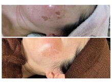 リ クリア(Re Clear)