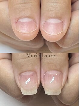 マリーロール 梅田店(Marie Laure)/自爪育成/深爪矯正/ネイルケア