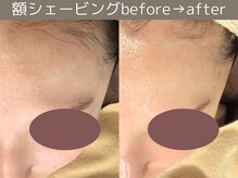 ももとゆでたまご/頬シェービング/ 新宿　渋谷２駅