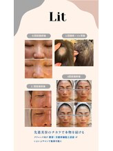 ラ トゥール(La tour)/臍帯・羊膜幹細胞エステ【Lit】