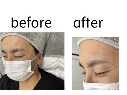 ロア(Roa)の写真