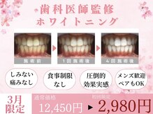 ホワイトニングカフェ 千葉店