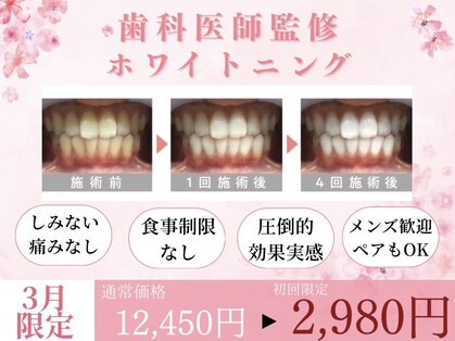 ホワイトニングカフェ 千葉店の写真