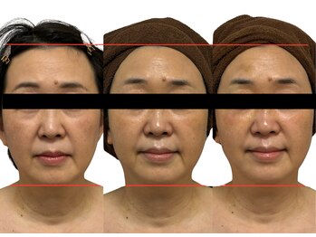 リノンクリニカル(LIINON clinical)/継続で美の再構築