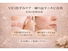 サロン ド ベル(Salon de Belle)/デリケートラインの黒ずみケア