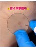 その首イボ、見られてますよ！(T_T)　プラズマ首集中ケアで解決！！(^_^)v