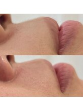 リリー(Lily)/FACE WAX