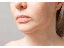 ウル(Ulu)/たるみ予防