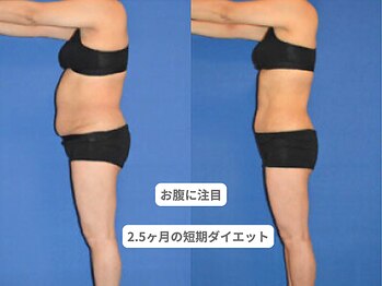 アンシャンテ 神戸元町店(Enchante)/痩身ダイエット　神戸元町三ノ宮