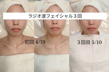 セレニテ(Serenite)
