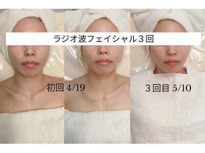 セレニテ(Serenite)の写真