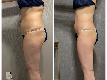 フュース(Futh)/お腹/腰回り/ダイエット