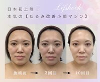 このはな(KONOHANA)