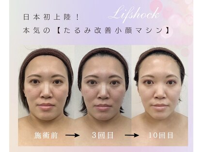 このはな(KONOHANA)の写真