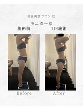 巴 松茂店/一回でもここまで変わる