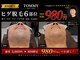 トミー(TOMMY)の写真