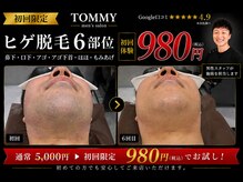 トミー(TOMMY)