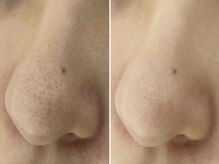 サロンドエルサ(Salon de ELSA)の雰囲気（毛穴の黒ずみ・開き・汚れ・たるみもお気軽にご相談くださいませ）