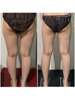 OBS/下半身集中モニター