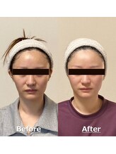 小顔22 ボルティ 赤坂支店(Bolty)/小顔シンメトリー矯正＆全身矯正