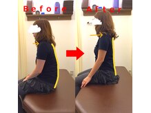 ゆかわ鍼灸整骨院/姿勢矯正