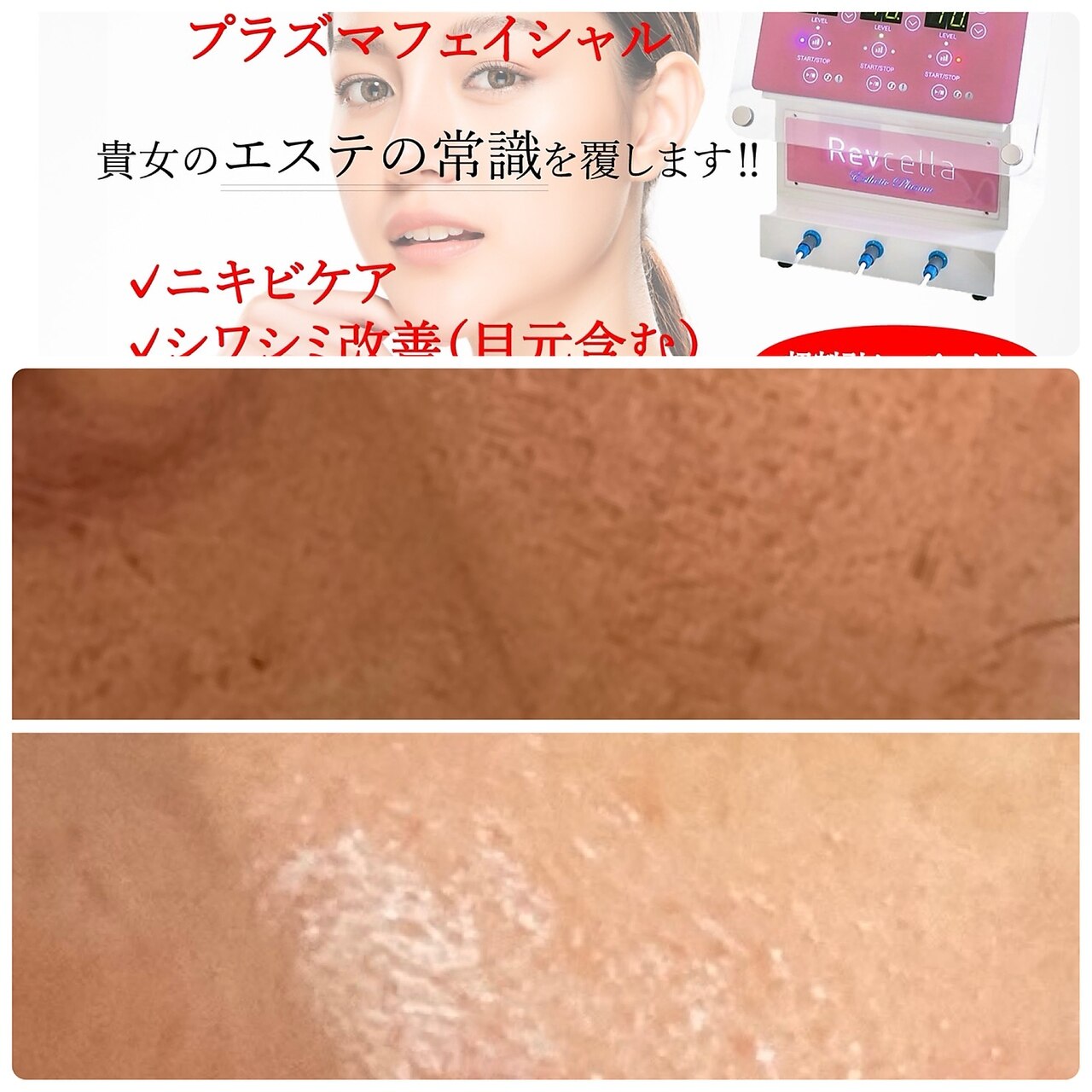 アデル(Adele)｜ホットペッパービューティー