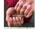 ネイルサロン プティ(Nailsalon Petit.)の写真/亀裂/ひび割れ/深爪などでお悩みの方に◎亀裂などの修正は1本からOK！【5本￥500～】長く美しい指先に♪