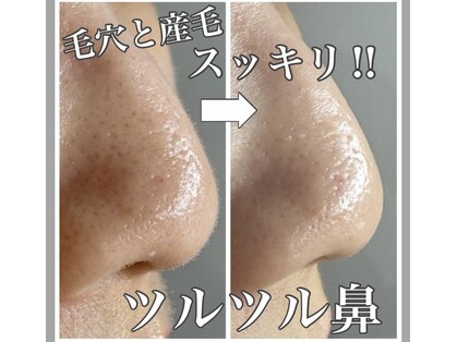 ルナ(LUNA)の写真