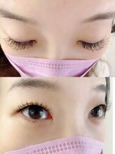 アイブライト(EYE Bright)/Dカール／Lシリーズ