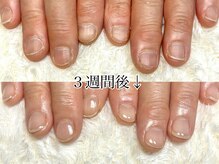 グラシナ 鳥丸店/1カラーを楽しみながら