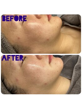 エヌココ(N_coco)/1度で実感！