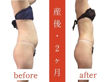ウィズルーチェ 麻布十番店(with luce)/３０代　産後　痩身