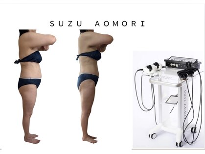 スズ(SUZU)の写真