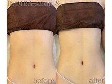 インディバサロン アンド(&.)/くびれ形成