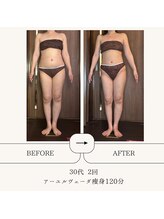 アーユルヴェーダアンドアロマエステ アユス(AYUS)/【40代】痩身1回目⇒2回目