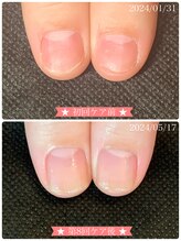 ネイルサロン ベルエトワール(belle etoile)/美爪育成ネイルケア3ヶ月コース