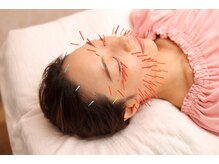 メイロン(meilong)/美容鍼灸