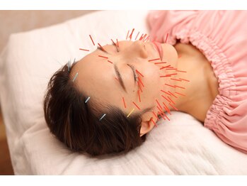 メイロン(meilong)/美容鍼灸