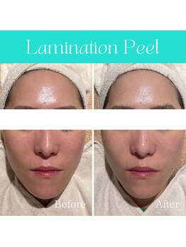 ハナイロ(hana-iro)/ラミネーションピール