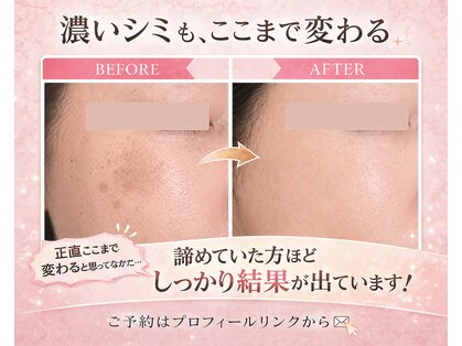 プラム(PLUM)の写真