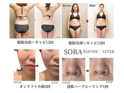 ソラ 天神 大名(SORA)の写真