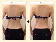 カロン(Kalon)/気になる腰の御肉もスッキリ