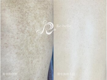 ビューティリュクス(beauty luxe)/背中美人になりませんか？