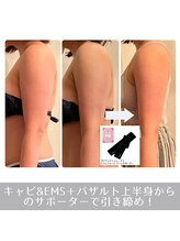 ラ ルミエール(La Lumiere)/更に効果upにはサポーター追加を
