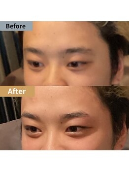 眉毛ハウス 吉祥寺店(眉毛HOUSE)/お客様の施術例(吉祥寺/東京)