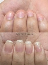 マリーロール 梅田店(Marie Laure)/自爪育成/深爪矯正/ネイルケア