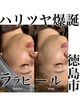 フルブルーム(Full Bloom)/ララピール　トーンアップB/A