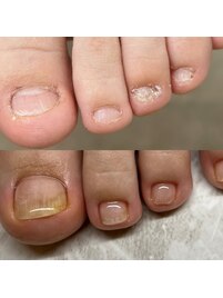 伸び悩む方へ　夏に向けて今から