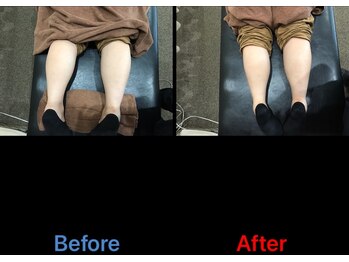 弁慶はりきゅう整骨院 大津市整骨院/施術の効果